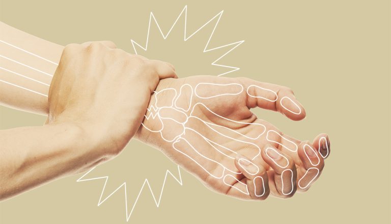 7 Kebiasaan Buruk yang Merusak Kesehatan Tulang Anda