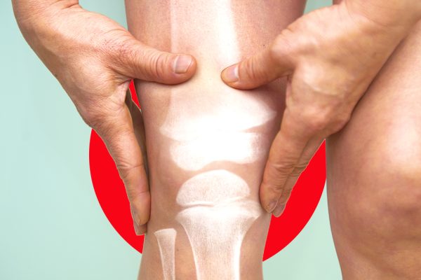 7 Kebiasaan Buruk yang Bisa Merusak Sendi Lutut 7 Kebiasaan Buruk yang Bisa Merusak Sendi Lutut