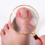 5 Cara Merawat Kuku Kaki Agar Tidak Tumbuh ke Dalam
