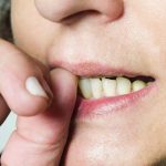 5 Kebiasaan Buruk yang Bisa Merusak Kesehatan Bibir