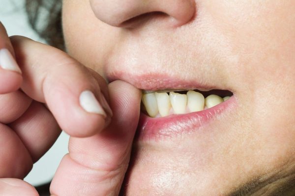 5 Kebiasaan Buruk yang Bisa Merusak Kesehatan Bibir 5 Kebiasaan Buruk yang Bisa Merusak Kesehatan Bibir