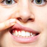 7 Tips Menghindari Gusi Berdarah saat Puasa7 Tips Menghindari Gusi Berdarah saat Puasa7 Tips Menghindari Gusi Berdarah saat Puasa7 Tips Menghindari Gusi Berdarah saat Puasa7 Tips Menghindari Gusi Berdarah saat Puasa7 Tips Menghindari Gusi Berdarah saat Puasa7 Tips Menghindari Gusi Berdarah saat Puasa7 Tips Menghindari Gusi Berdarah saat Puasa7 Tips Menghindari Gusi Berdarah saat Puasa7 Tips Menghindari Gusi Berdarah saat Puasa7 Tips Menghindari Gusi Berdarah saat Puasa7 Tips Menghindari Gusi Berdarah saat Puasa7 Tips Menghindari Gusi Berdarah saat Puasa7 Tips Menghindari Gusi Berdarah saat Puasa7 Tips Menghindari Gusi Berdarah saat Puasa