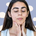 7 Tips Menghindari Komedo di Area Dagu