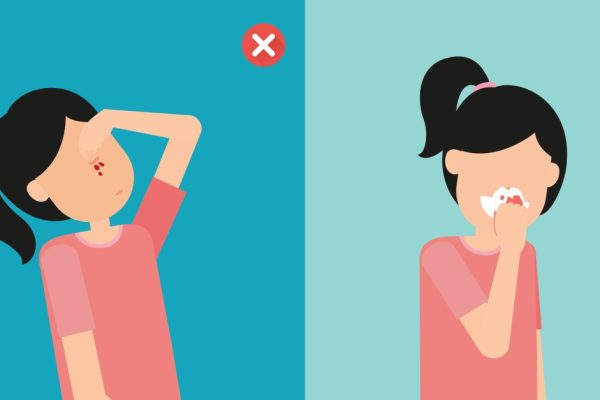7 Tips Mengatasi Mimisan Secara Cepat dan Aman 7 Tips Mengatasi Mimisan Secara Cepat dan Aman