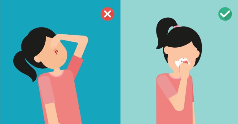 7 Tips Mengatasi Mimisan Secara Cepat dan Aman