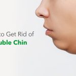 5 Tips Mencegah Dagu Ganda (Double Chin) Sejak Dini