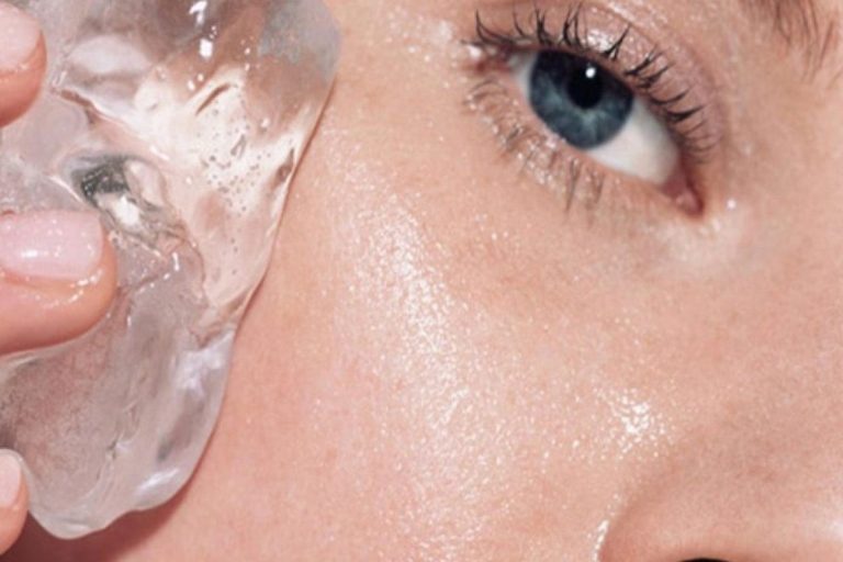 7 Cara Cepat Mengempeskan Jerawat Meradang